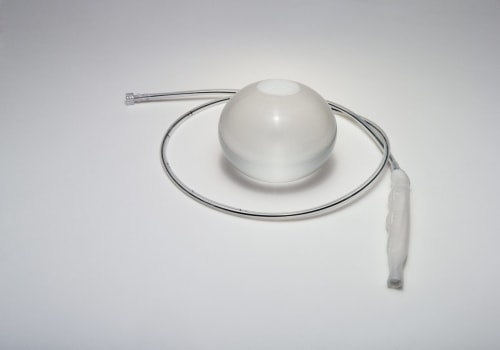 Gastric Balloon for Weight Loss: Exploring the Benefits and Risks